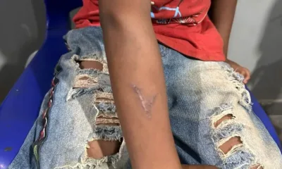 governo-do-tocantins-cria-comissao-para-investigar-suposto-crime-contra-crianca-indigena-karaja